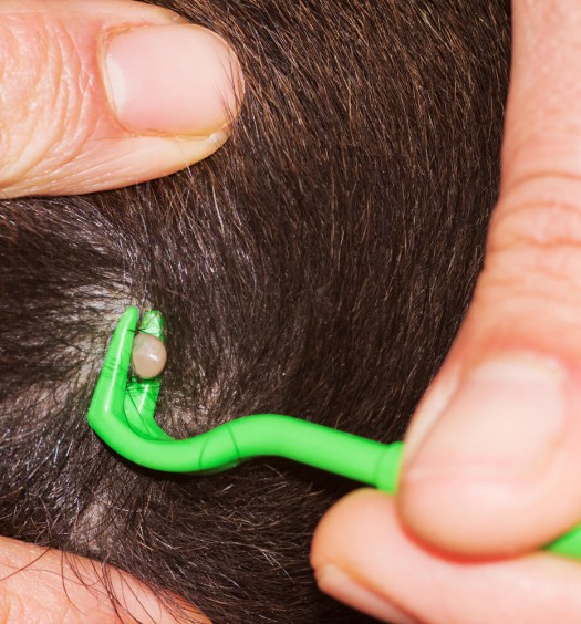 uncino per zecche cani